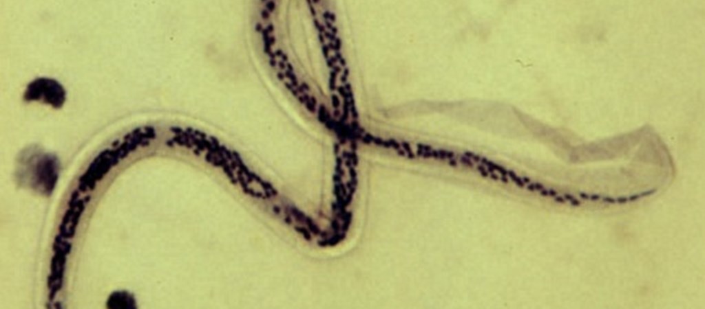 Instant tudomány: Parazita is okozhat rákot, elképedtek a tudósok | streetcolor.hu