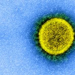 The 16-year-old girl is the youngest victim of the coronavirus epidemic in Hungary